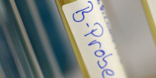 Допинг-проба