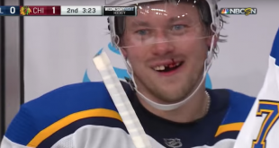 Тарасенко зуб НХЛ